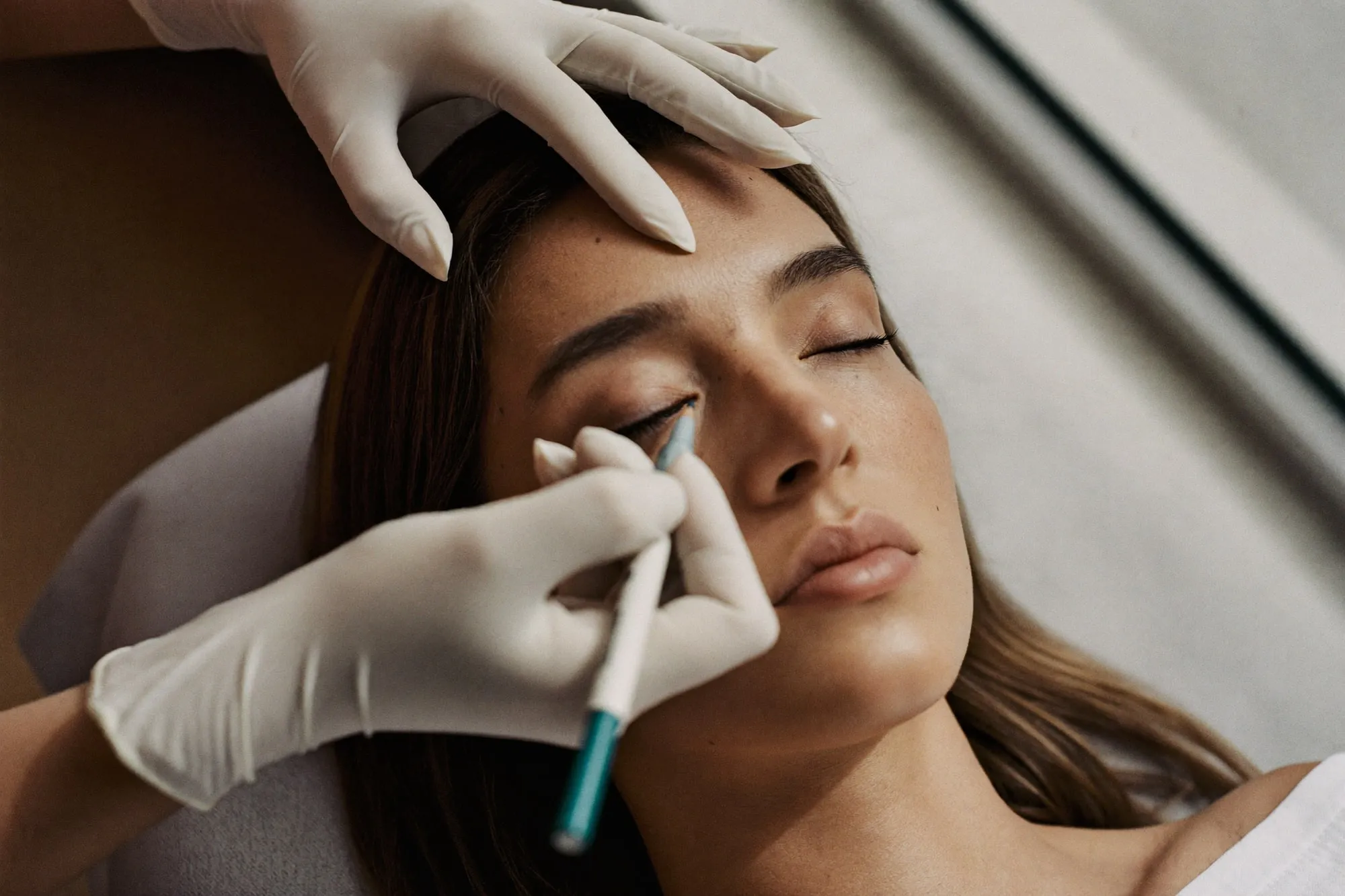 Consulta de toxina botulínica na Bella Laser Clinic, no Porto